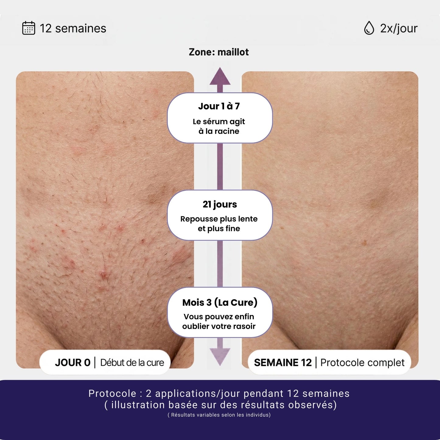 Sérum naturel Anti-Repousse