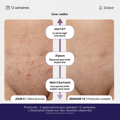 Sérum naturel Anti-Repousse