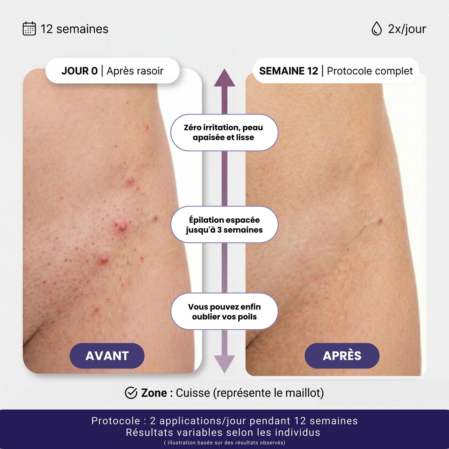 Sérum naturel réducteur de repousse